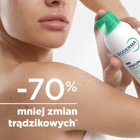 mniej zmian tradzikowych