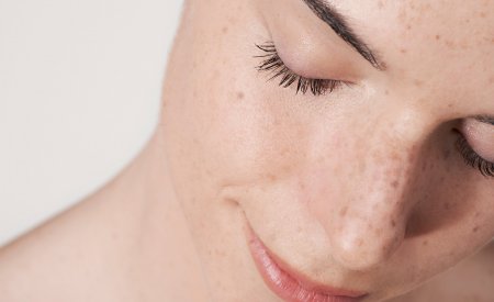 eyelid irritation