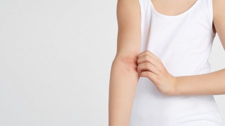 Bioderma - atopic skin itching Bioderma - atopic skin itching