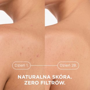 Kerato+ Body Effects on skin