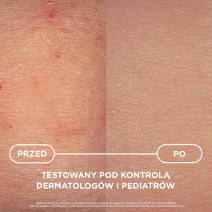 Atoderm AD Intensive Baume - produkt testowany naukowo