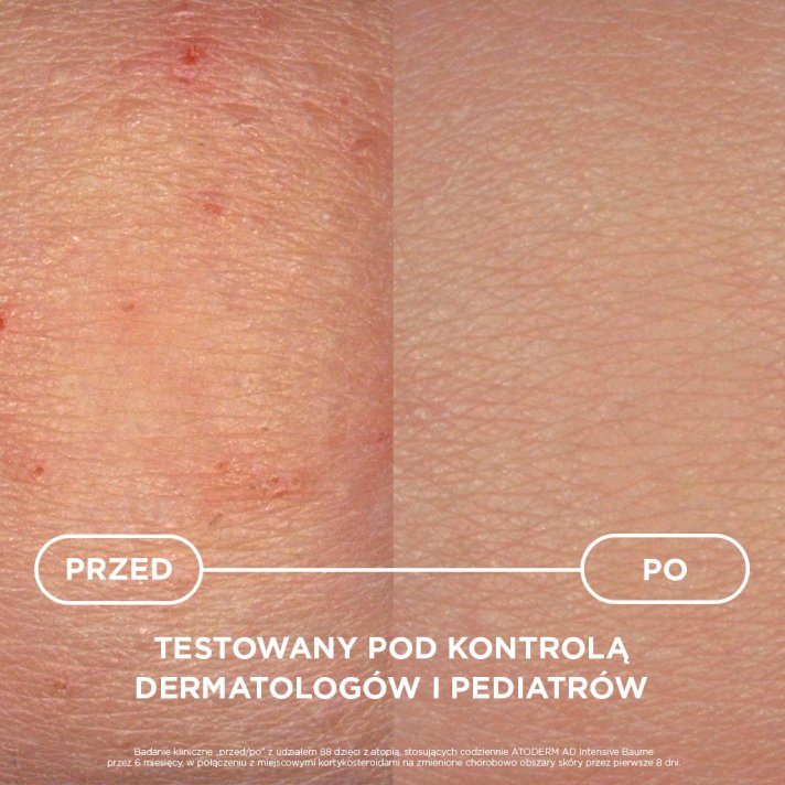 Atoderm AD Intensive Baume - produkt testowany naukowo